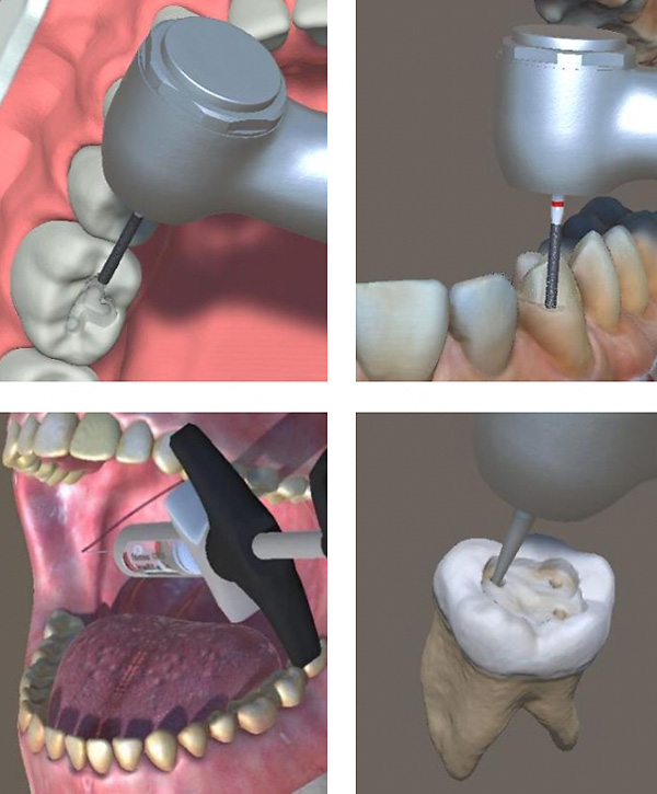 Bild Dental-Simulator Anwedungsbilder